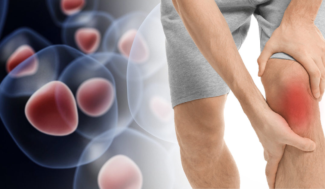 Captivating Where Can I Get Stem Cell Treatment For Knee Capture in HD Captivating Where Can I Get Stem Cell Treatment For Knee Capture in HD